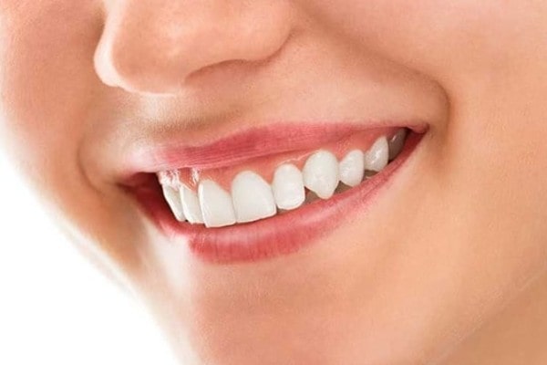 Tooth Whitening